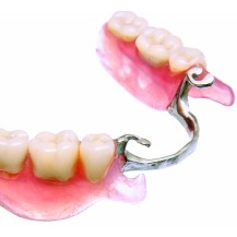 ACRON Rokodent | Resina Termoplástica para Prótese Dentária